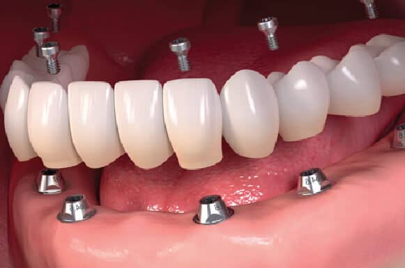 Spruhad Multispeciality Clinic - Best dentist in Pune | Best dental clinic in Pune