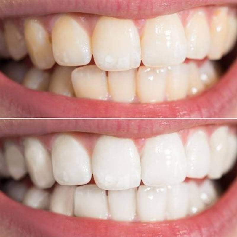 Spruhad Multispeciality Clinic - Best dentist in Pune | Best dental clinic in Pune