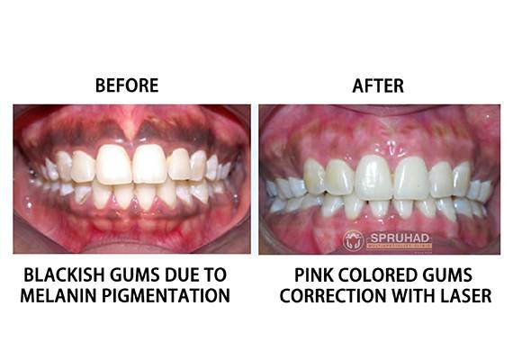 Spruhad Multispeciality Clinic - Best dentist in Pune | Best dental clinic in Pune