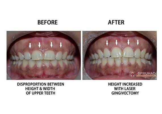 Spruhad Multispeciality Clinic - Best dentist in Pune | Best dental clinic in Pune