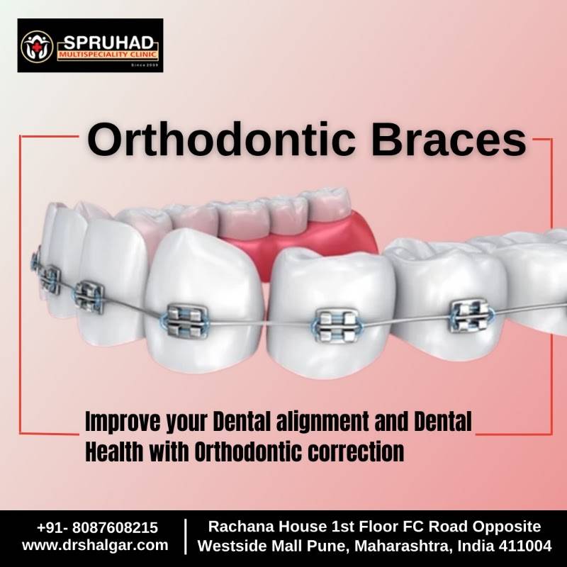 Spruhad Multispeciality Clinic - Best dentist in Pune | Best dental clinic in Pune