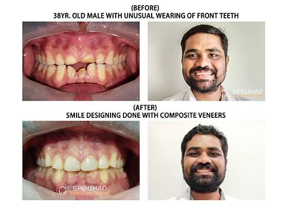 Spruhad Multispeciality Clinic - Best dentist in Pune | Best dental clinic in Pune