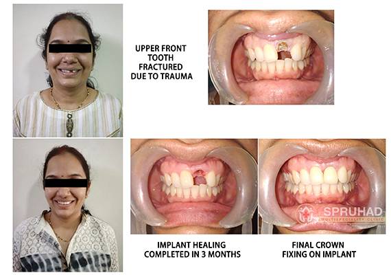 Spruhad Multispeciality Clinic - Best dentist in Pune | Best dental clinic in Pune