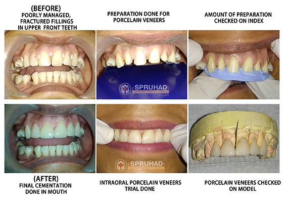 Spruhad Multispeciality Clinic - Best dentist in Pune | Best dental clinic in Pune