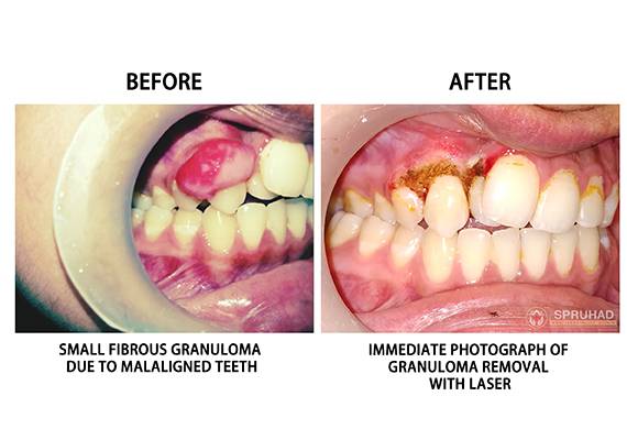 Spruhad Multispeciality Clinic - Best dentist in Pune | Best dental clinic in Pune