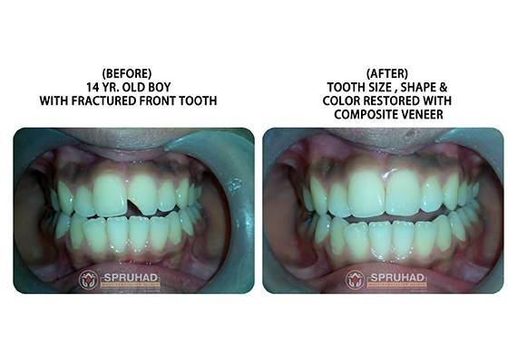 Spruhad Multispeciality Clinic - Best dentist in Pune | Best dental clinic in Pune