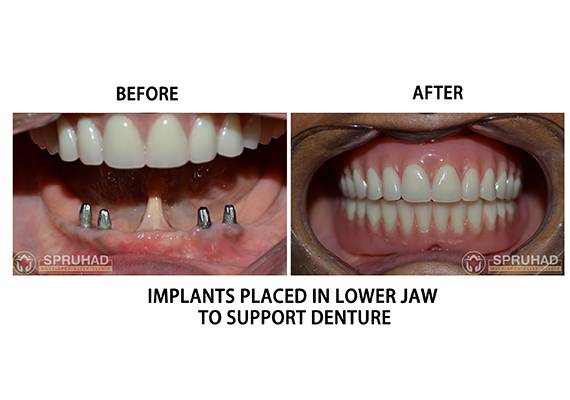 Spruhad Multispeciality Clinic - Best dentist in Pune | Best dental clinic in Pune