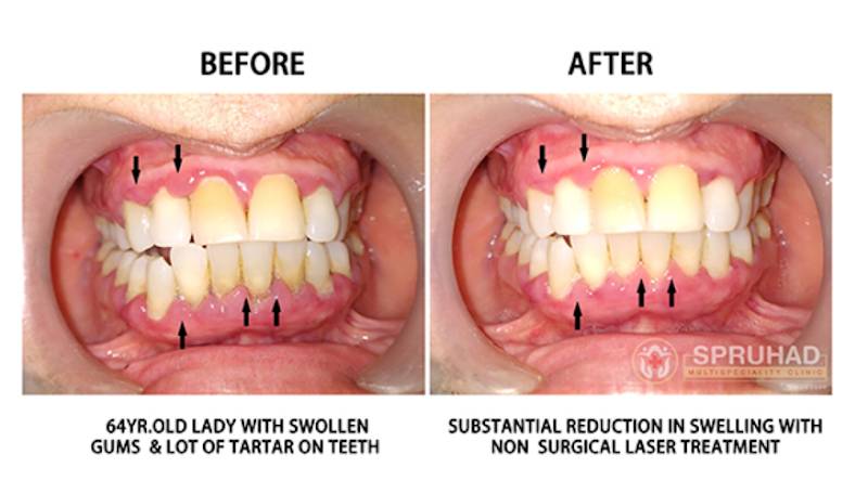 Spruhad Multispeciality Clinic - Best dentist in Pune | Best dental clinic in Pune