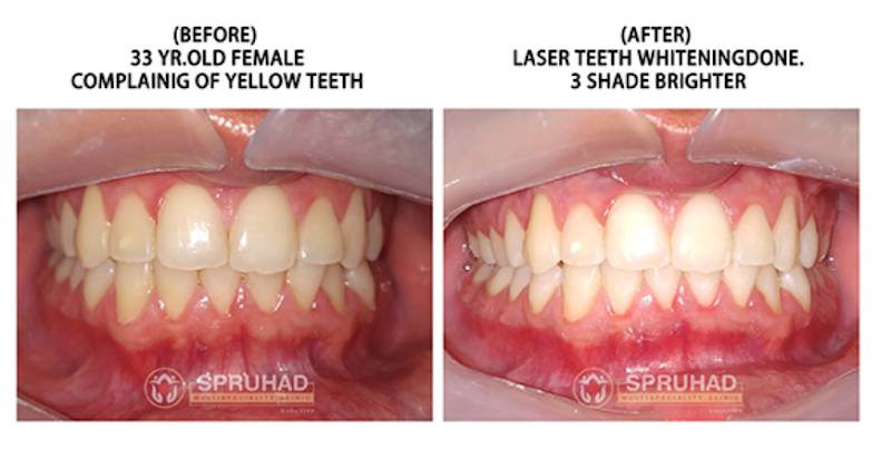 Spruhad Multispeciality Clinic - Best dentist in Pune | Best dental clinic in Pune