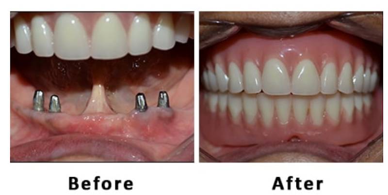 Spruhad Multispeciality Clinic - Best dentist in Pune | Best dental clinic in Pune