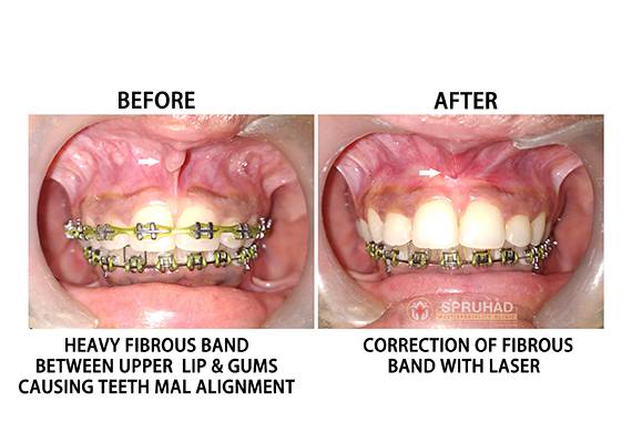 Spruhad Multispeciality Clinic - Best dentist in Pune | Best dental clinic in Pune